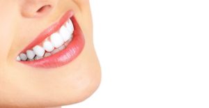 a woman's smile shows off her whitened teeth