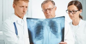 three doctors look at an xray for a pulmonary embolism