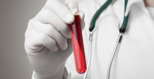 a doctor shakes a vial of blood during a test for hiv treatments